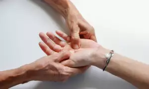 Minoxidil